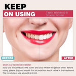 Pdoo Teeth Whitening Kit